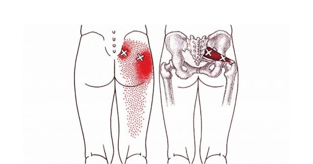 Sciatica Nerve Stretches