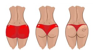 What Does Your Butt Shape Say About You