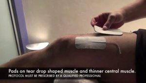 Quick Guide on Electrical Muscle Stimulation