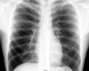 How to Manuscape Chest