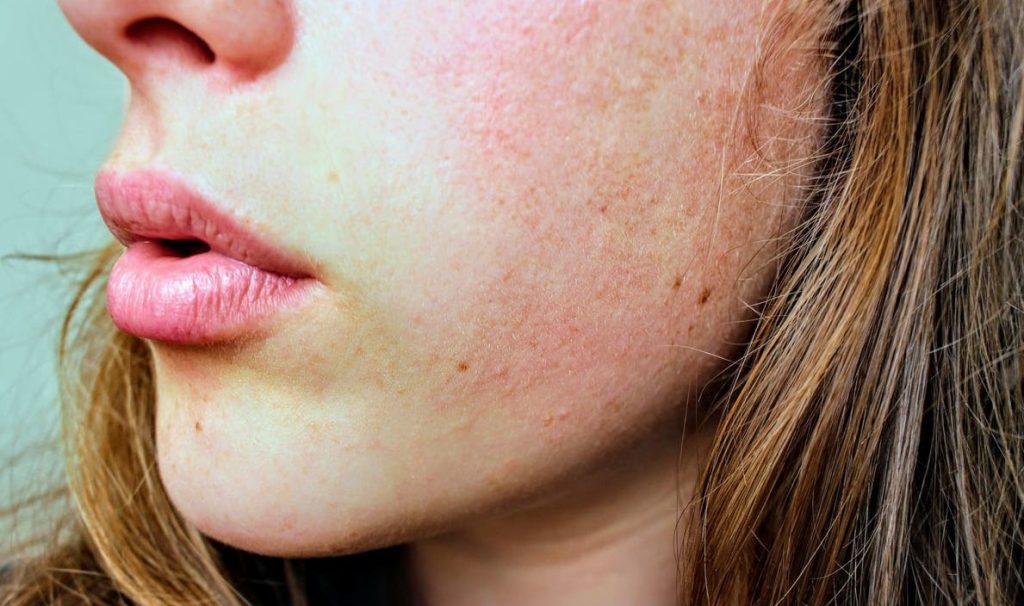 7 Signs Your Skin Care Routine Needs a Reboot