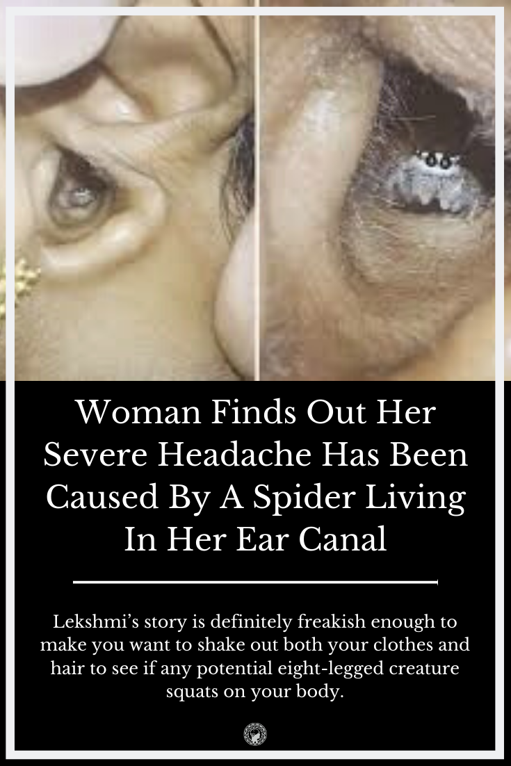 Woman Finds Out Her Severe Headache Has Been Caused By A Spider Living In Her Ear Canal