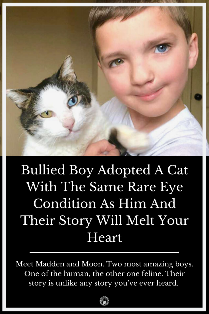 Bullied Boy Adopted A Cat With The Same Rare Eye Condition As Him And Their Story Will Melt Your Heart