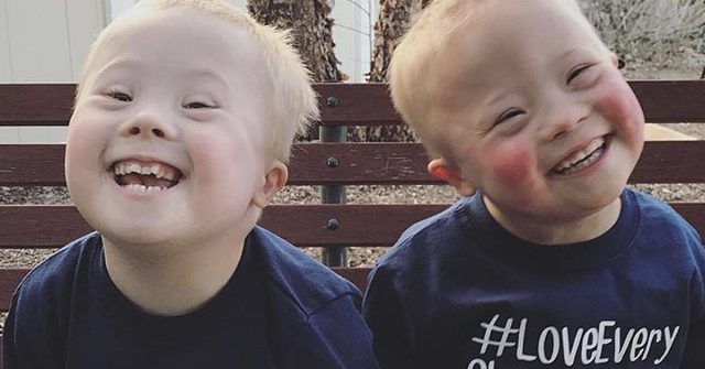 twins with down syndrome