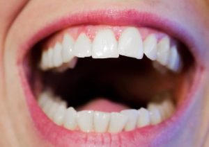 Oral Hygiene Tips That You Must Not Ignore