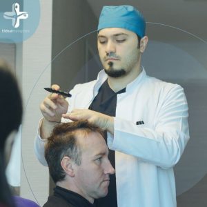 Hair Transplant in Turkey – Safe or Procedure at Risk?