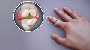 7 of the Most Common Medical Conditions That Effect the Elderly