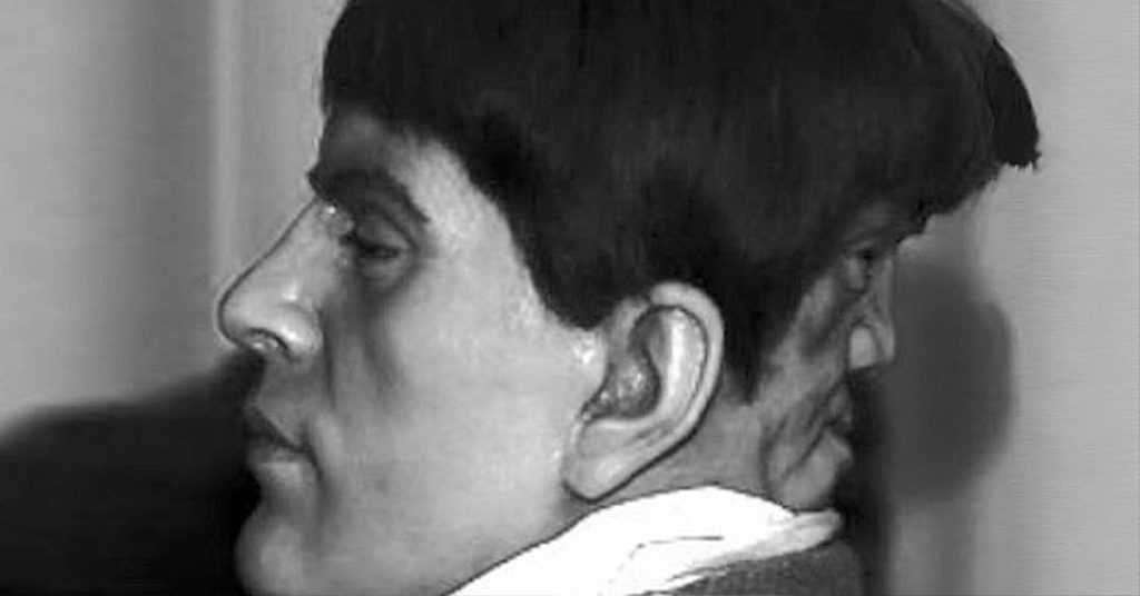 The Real Story Of Edward Mordrake, The Man With Two Faces