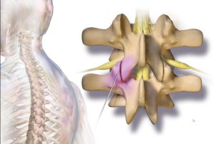 How to Achieve Lumbar Support at Home