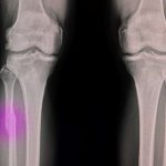 X-ray knee