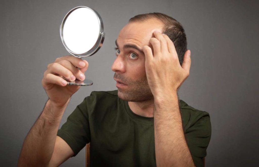 What to Expect in Scalp Micropigmentation Los Angeles