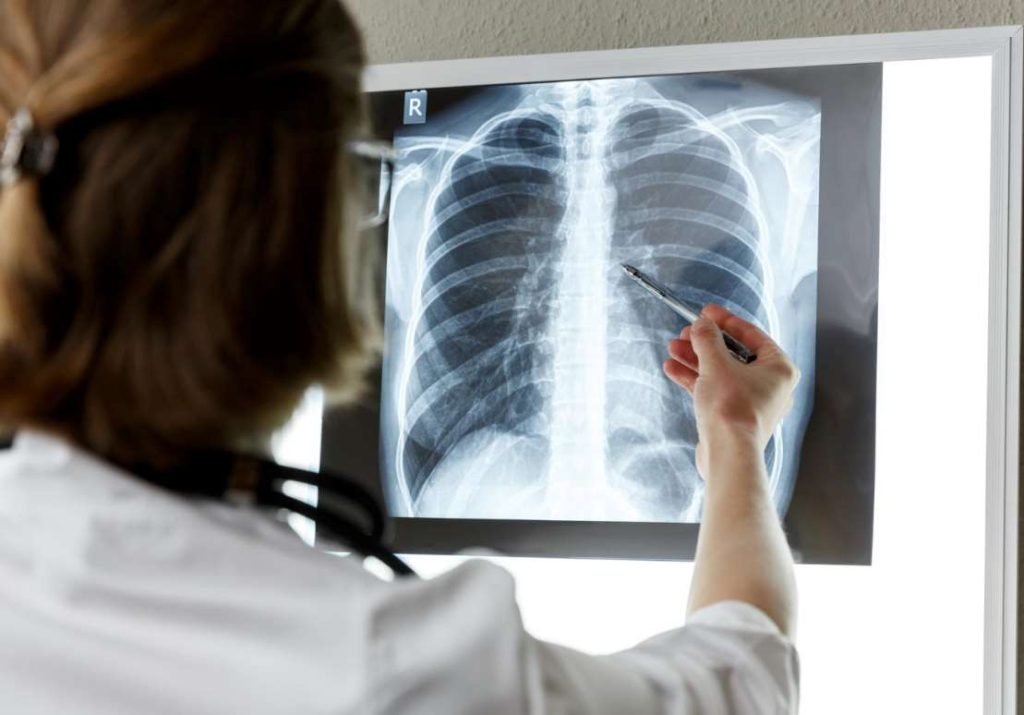 7 Tips for Mesothelioma Caregivers