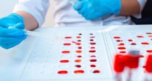 Lab blood type test