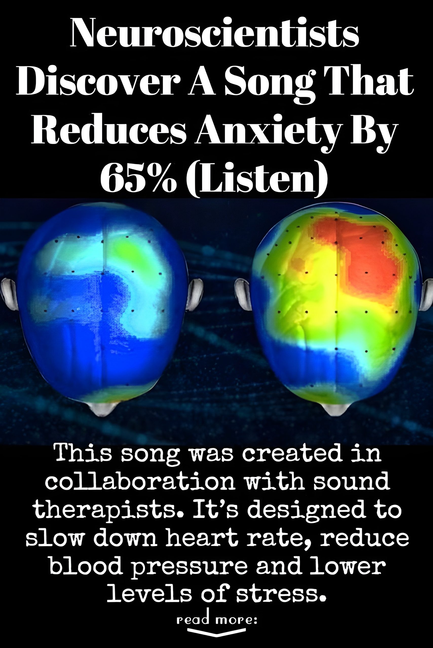Neuroscientists Discover Music To Calm Anxiety By 65% (Listen)