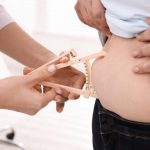 Preparing for Gastric Bypass Surgery