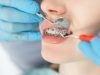 Orthodontist Appointment