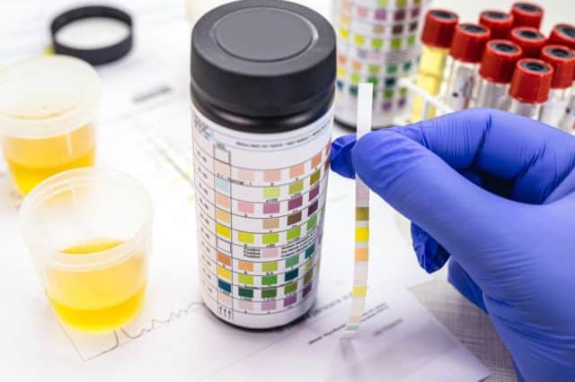 urine test