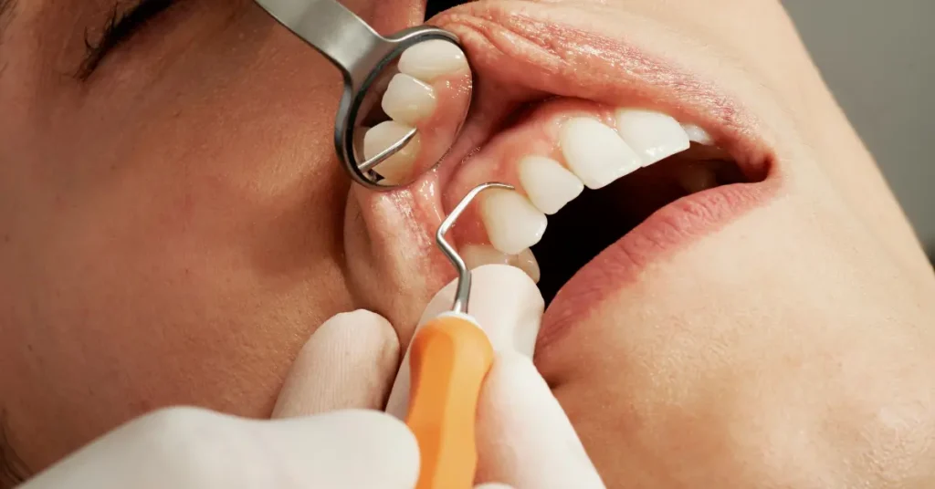 5 Signs You May Need To See a Cosmetic Dentist