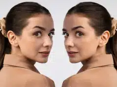 Achieving a Sculpted Face: Understanding Fat Reduction and Contouring Solutions