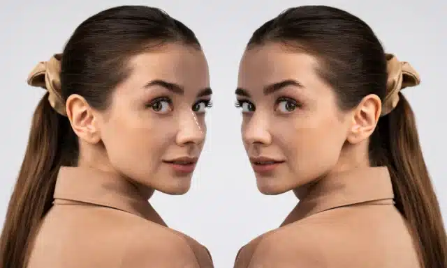 Achieving a Sculpted Face: Understanding Fat Reduction and Contouring Solutions