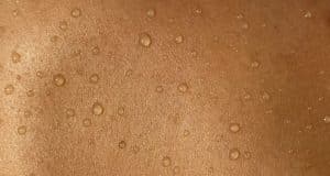 Skin Checks for Cancer Prevention