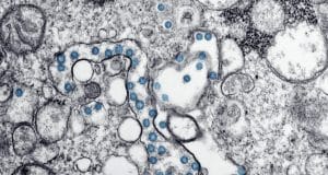 The Surprising Role of Microbiomes in Mental Clarity
