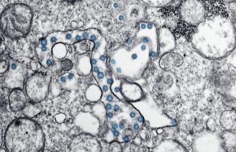 The Surprising Role of Microbiomes in Mental Clarity