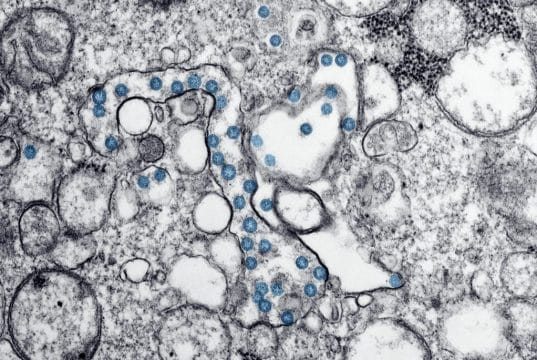 The Surprising Role of Microbiomes in Mental Clarity