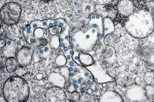 The Surprising Role of Microbiomes in Mental Clarity